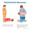 Heimlich Maneuver: Langkah Cepat Selamatkan Nyawa!