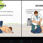 DRCAB vs. DRACB: Memahami Urutan Pertolongan Pertama yang Krusial